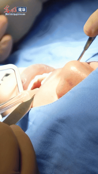 【“人工智能+”惠民生】VLOG丨全球首个AI+VR:5分钟上手,秒变初级口腔种植医生 【“人工智能+”惠民生】VLOG丨全球首个AI+VR:5分钟上手,秒变初级口腔种植医生