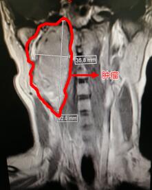 字少情长 这封古诗体感谢信背后是一台长达15小时的接力手术