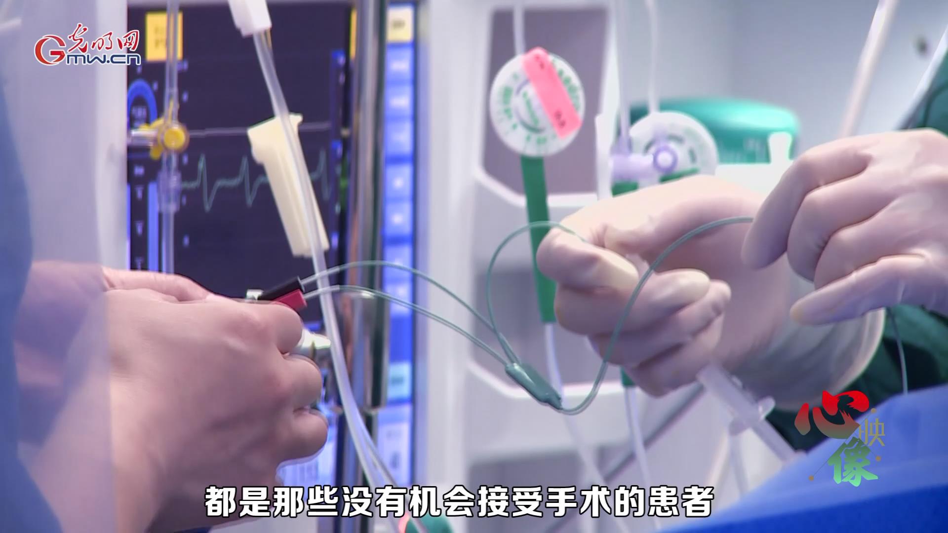 【光明卫生•心映像】刘巍:用不开胸的手术,保护最后一道生门 【光明卫生•心映像】刘巍:用不开胸的手术,保护最后一道生门