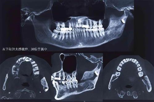 面部肿胀别大意 严重时会危及生命